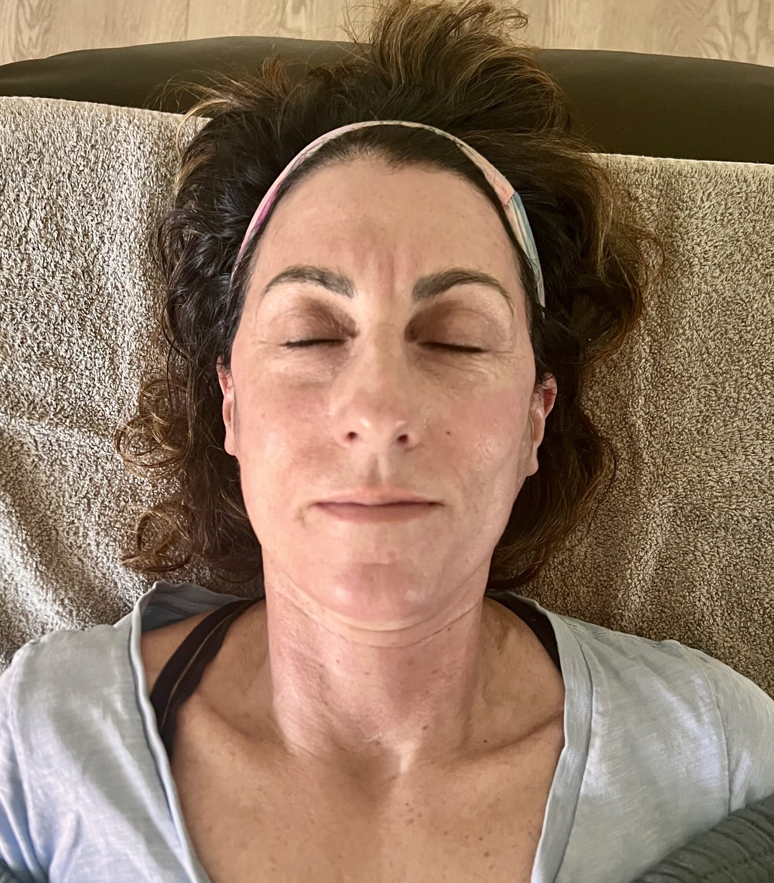 Client relaxing while receiving microneedling treatment 